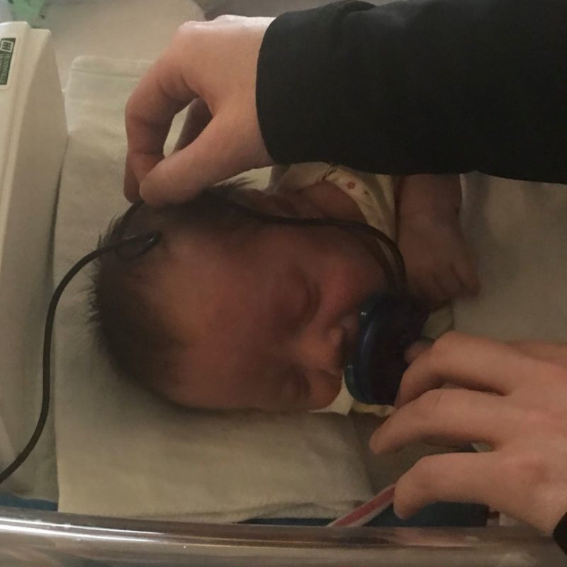 A NICU baby is hooked up to a pacifier activated lullaby device that plays music to encourage sucking behaviors. 