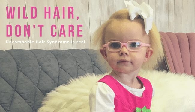 My Daughter Has Uncombable Hair Syndrome | Rocket City Mom | Huntsville  events, activities, and resources for families.