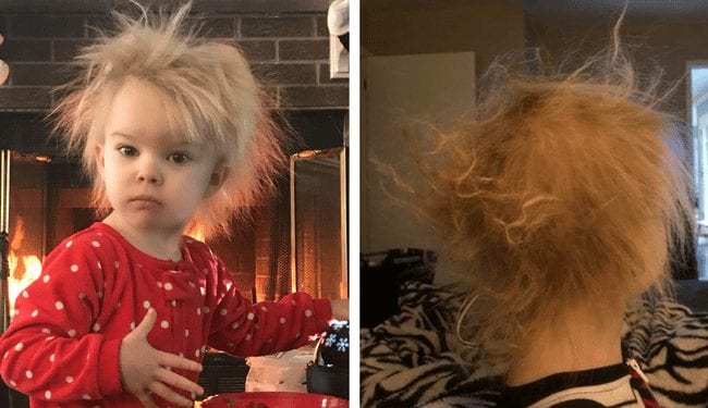 My Daughter Has Uncombable Hair Syndrome | Rocket City Mom | Huntsville  events, activities, and resources for families.
